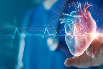 A physician touches a scan of a patient's heart
